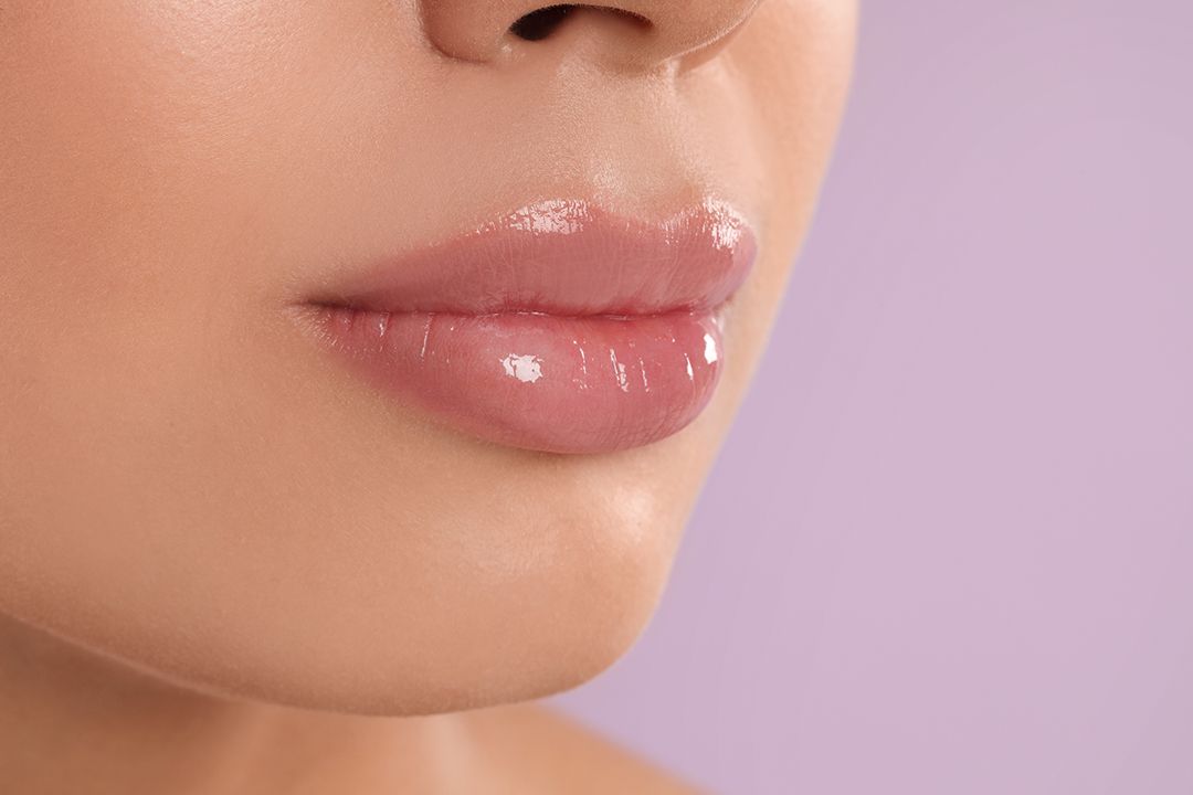 Ácido hialurónico en labios en La Palma — Ocean Clinik